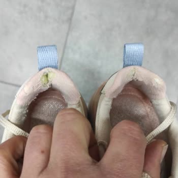 Skechers Ayakkabıda Beklenmedik Aşınma Ve Yırtılma Sorunu