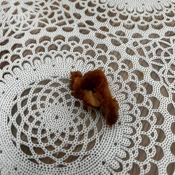 Adana Dürüm Siparişimde Şok Edici Bulgular