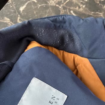 Beymen Ürününün Beklenmedik Kalite Sorunları