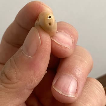 Duymer İşitme Cihazları Ücretsiz Değişim Sözü Yerine Getirilmedi