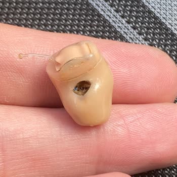 Duymer İşitme Cihazları Ücretsiz Değişim Sözü Yerine Getirilmedi