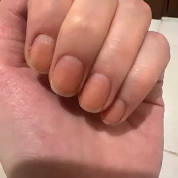 Flormar Oje Tırnaklarımda Kalıcı Leke Bıraktı