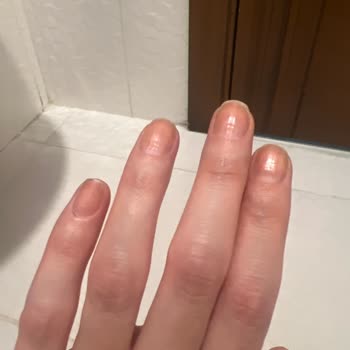 Flormar Oje Tırnaklarımda Kalıcı Leke Bıraktı