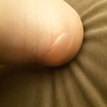 U1 Urban One Hatalı Ürün Ve İade Sorunu