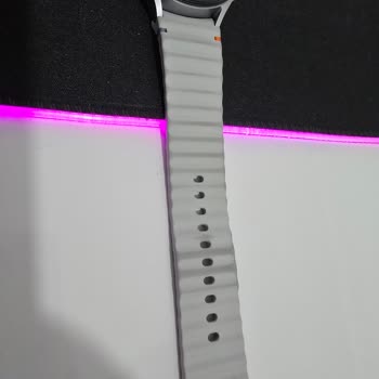 Samsung Saat Kordonu Renk Değişimi Ve Yetersiz Destek