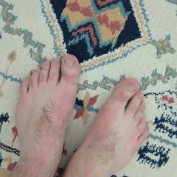 Skechers Ayakkabı Değişiminde Sorun Ve İlgisizlik