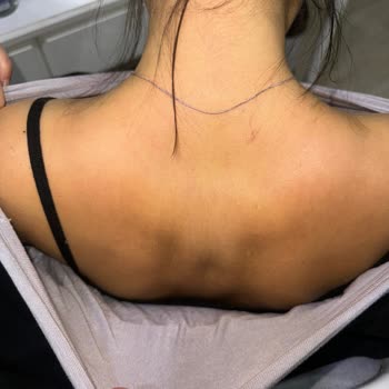 Isana Alerji Yapan Ürünle Hayal Kırıklığı