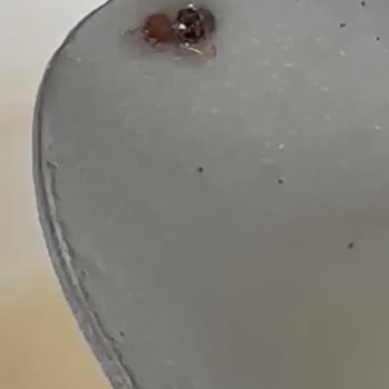 Liv Hospital Özel Hastanede Hijyen Ve Fatura Sorunları