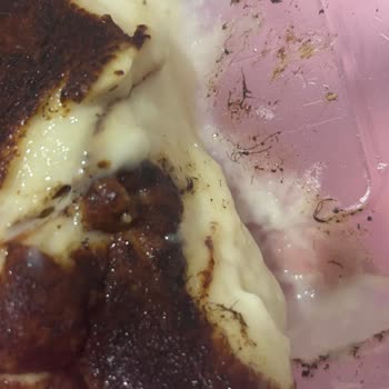 Hijyen Sorunu Ve Sağlık Tehlikesi