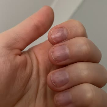 Yanlış Uygulama Ve Bilinçsiz Makine Kullanımı Tırnaklarımı Mahvetti