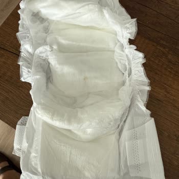 Hijyen Skandalı: Kirli Bebek Bezi Şoku