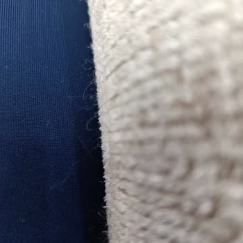 Çetmen Koltuklarında Tüylenme Ve Bitlenme Sorunu