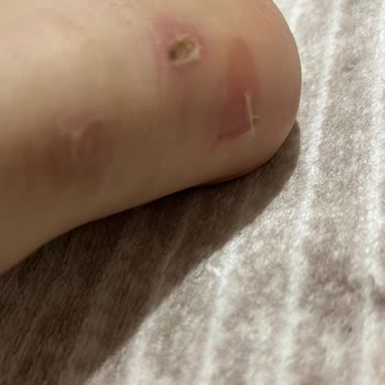 Bot Sorunu Ve Müşteri Hizmetleri Hayal Kırıklığı