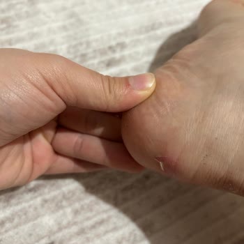 Bot Sorunu Ve Müşteri Hizmetleri Hayal Kırıklığı