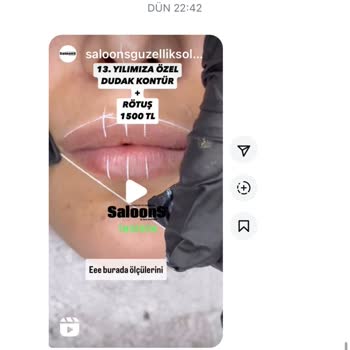 Güzellik Merkezinin İzinsiz Video Kullanımı Ve Yanıltıcı Reklamlar