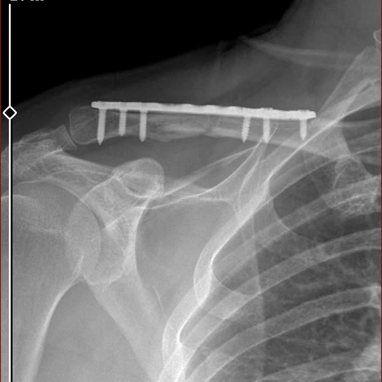 Sigorta Tazminatı İçin Bahaneler Üreten Şirket