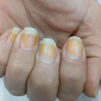 Flormar Oje Kullanımı Sonrası Tırnak Sağlığı Sorunu