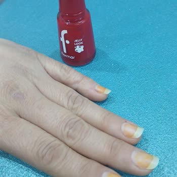 Flormar Oje Kullanımı Sonrası Tırnak Sağlığı Sorunu