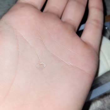 BİM'den Aldığım Çiğköftenin İçinden Cam Çıktı!