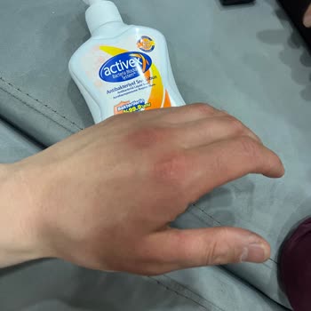 Activex Sabunu Ciltte Tahriş Ve Kızarıklık Yaptı!