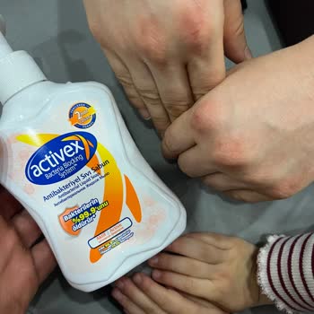 Activex Sabunu Ciltte Tahriş Ve Kızarıklık Yaptı!