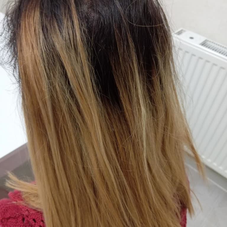 Dermogold Estetik Kötü Hizmet Ve İlgisizlikle Mahvolan Saç Deneyimi