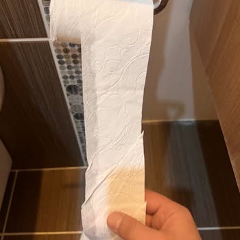 Selpak Deluxe Tuvalet Kağıdında Kalite Düşüşü Ve Paket Sorunu