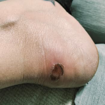 Ayakkabı Mağazasının Sorumsuzluğu Sağlığımı Tehlikeye Atıyor!