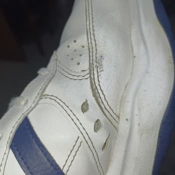 Adidas Ayakkabılarda Erken Deformasyon Ve Kalite Sorunları
