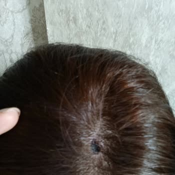 Palette Saç Boyası İle Yanma Sorunu