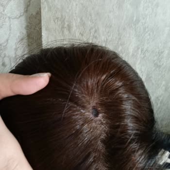 Palette Saç Boyası İle Yanma Sorunu