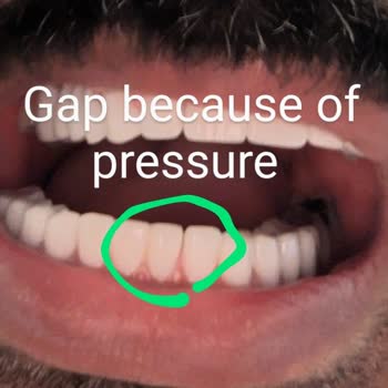 Novus Klinik Kaplamada Hayal Kırıklığı