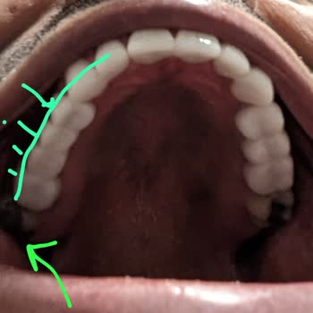 Novus Klinik Kaplamada Hayal Kırıklığı