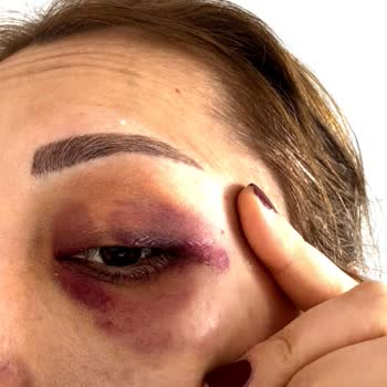 Avantgarde Urban Hotel Levent Şikayetçiyim