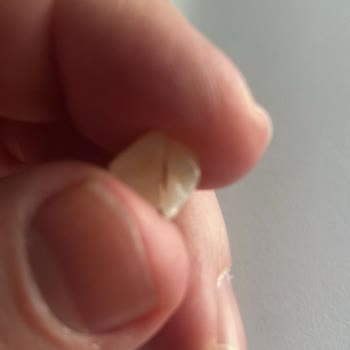 Linadent Ağız Ve Diş Sağlığı Polikliniği'nde Diş Yaptırdım Pişmanım Ve Hiç Memnun Değilim