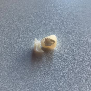 Linadent Ağız Ve Diş Sağlığı Polikliniği'nde Diş Yaptırdım Pişmanım Ve Hiç Memnun Değilim