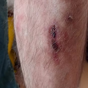 A101 Tenceresi Sağlık Ve Tat Sorunları Yaratıyor