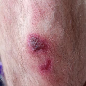 A101 Tenceresi Sağlık Ve Tat Sorunları Yaratıyor