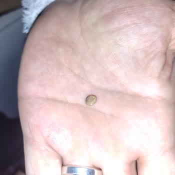 Baklavadan Çıkan Taşla Gelen Hayal Kırıklığı