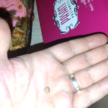 Baklavadan Çıkan Taşla Gelen Hayal Kırıklığı