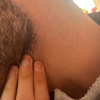 Sevim Alan Güzellik Merkezi Kars Şubesinde Epilasyon Kabusu