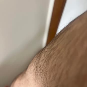 Sevim Alan Güzellik Merkezi Kars Şubesinde Epilasyon Kabusu