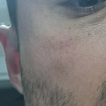 Aldatıcı Krem: Fayda Yerine Zarar!