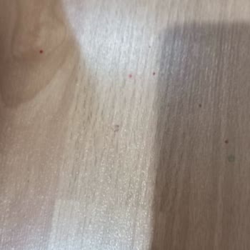 Trendyol'da İade Sürecinde Yaşanan Sorunlar