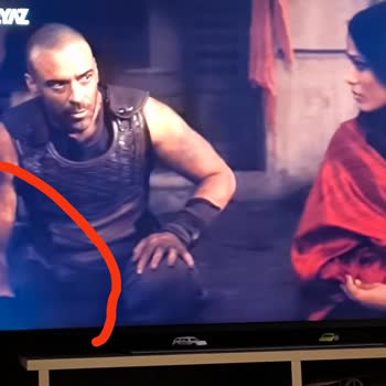 LG TV Köşelerindeki Beyazlama Sorunu