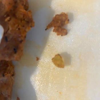 Çiğ Köftede Cam Parçası Ve İlgisizlik Skandalı
