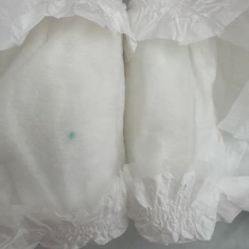 Sleepy Bebek Bezi İçerisinde Sert Cisim Tehlikesi