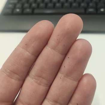 Neutrogena Krem Sonrası Ciltte Pullanma Ve Kaşıntı