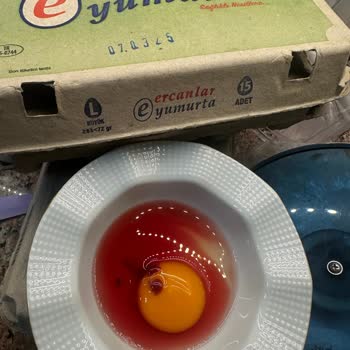 Son Kullanma Tarihi Geçmiş Ürünler: Sağlığımız Tehlikede!