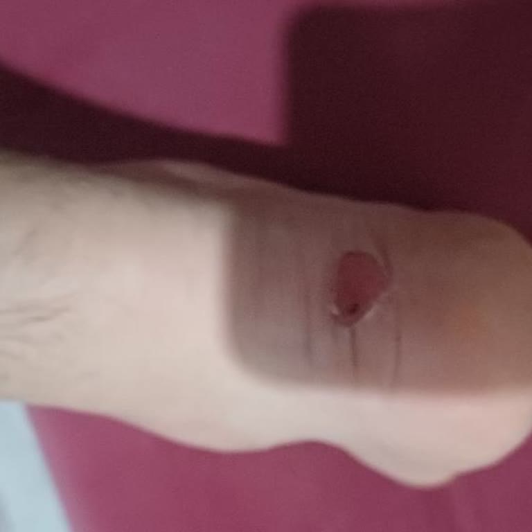 FLO'dan Aldığım Bot Ayaklarımı Tahriş Etti!
